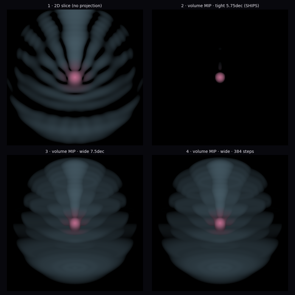 2-D slice compared against volume renders at several brightness windows and step counts